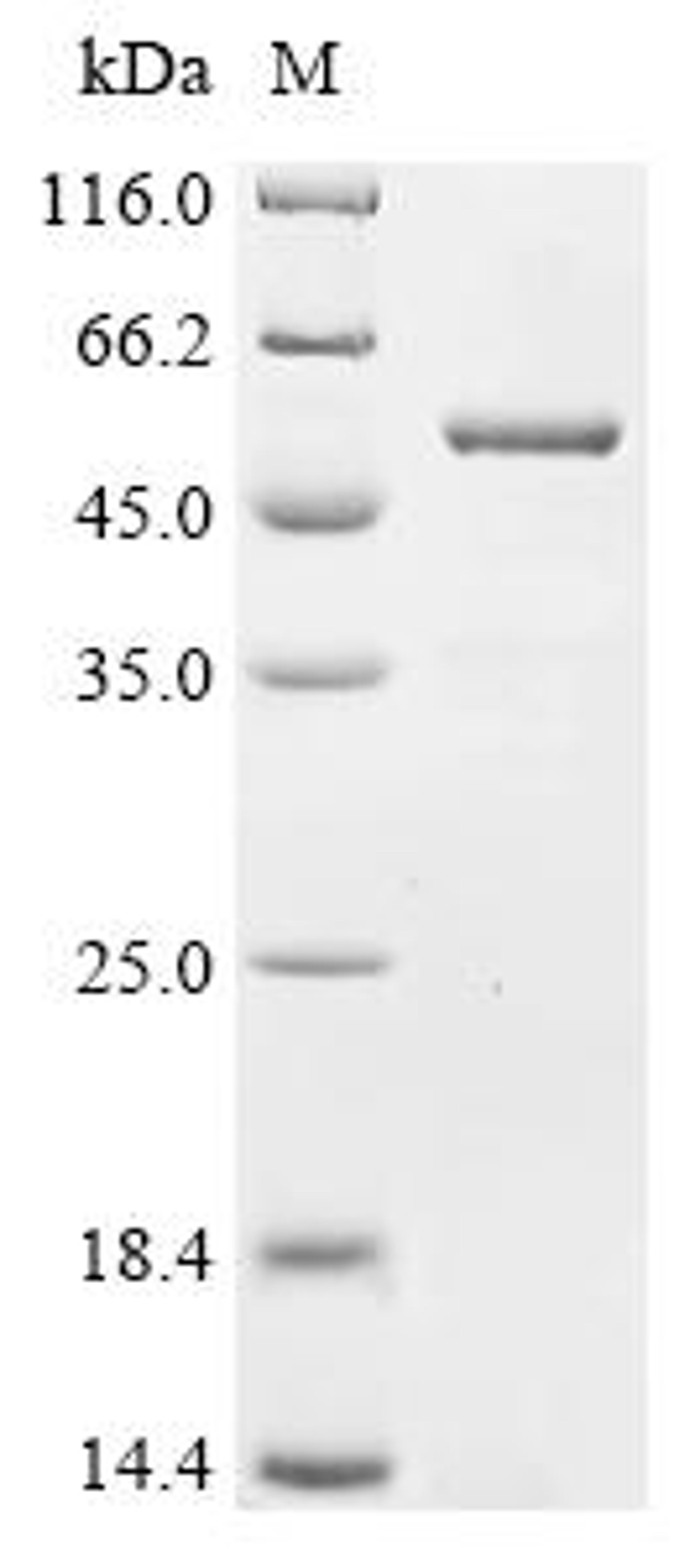 (Tris-Glycine gel) Discontinuous SDS-PAGE (reduced) with 5% enrichment gel and 15% separation gel.
