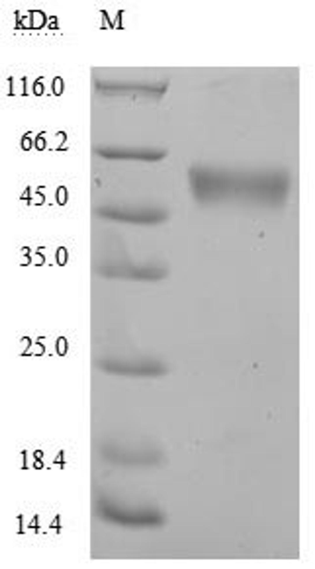 (Tris-Glycine gel) Discontinuous SDS-PAGE (reduced) with 5% enrichment gel and 15% separation gel.