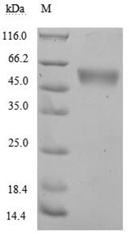 (Tris-Glycine gel) Discontinuous SDS-PAGE (reduced) with 5% enrichment gel and 15% separation gel.