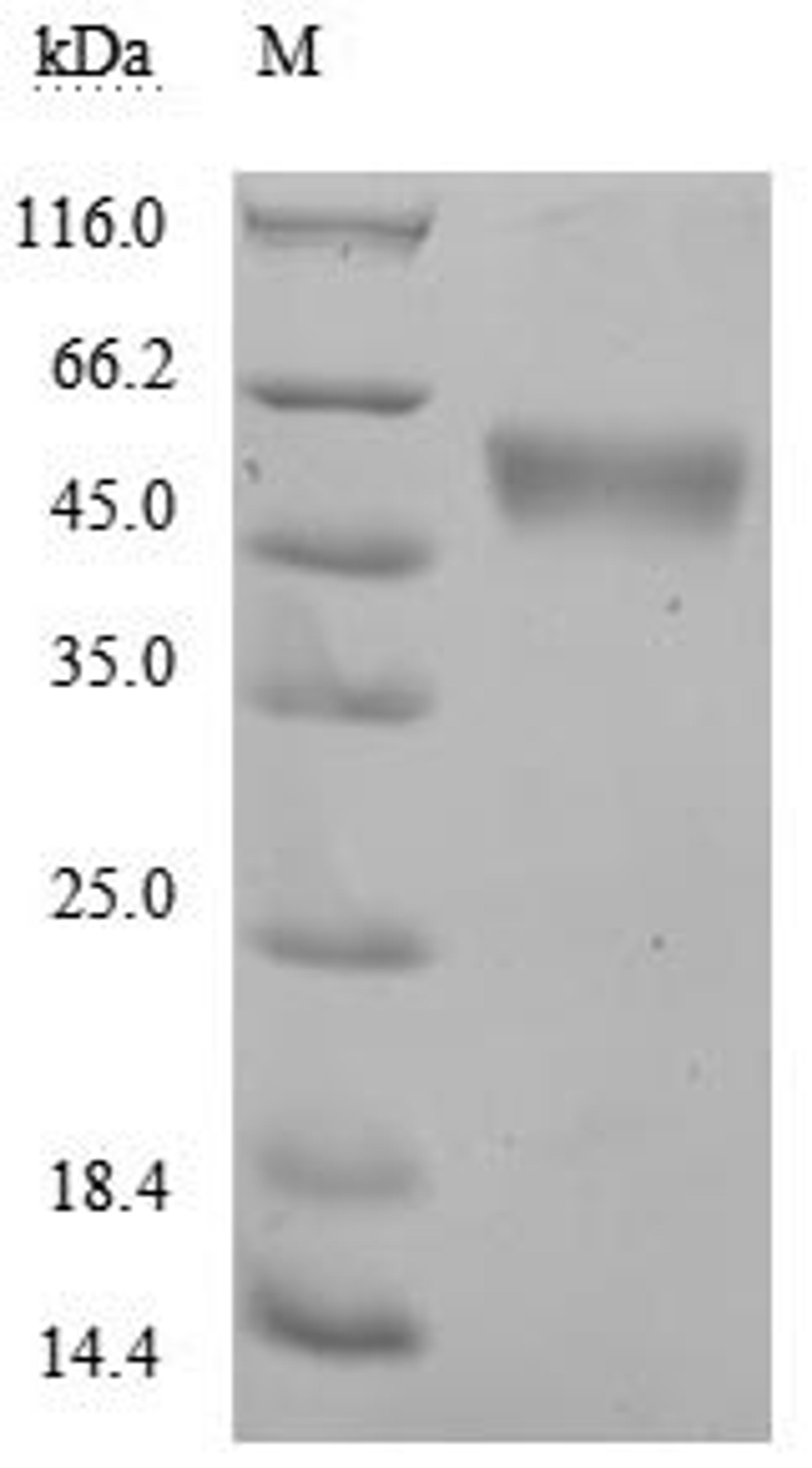 (Tris-Glycine gel) Discontinuous SDS-PAGE (reduced) with 5% enrichment gel and 15% separation gel.