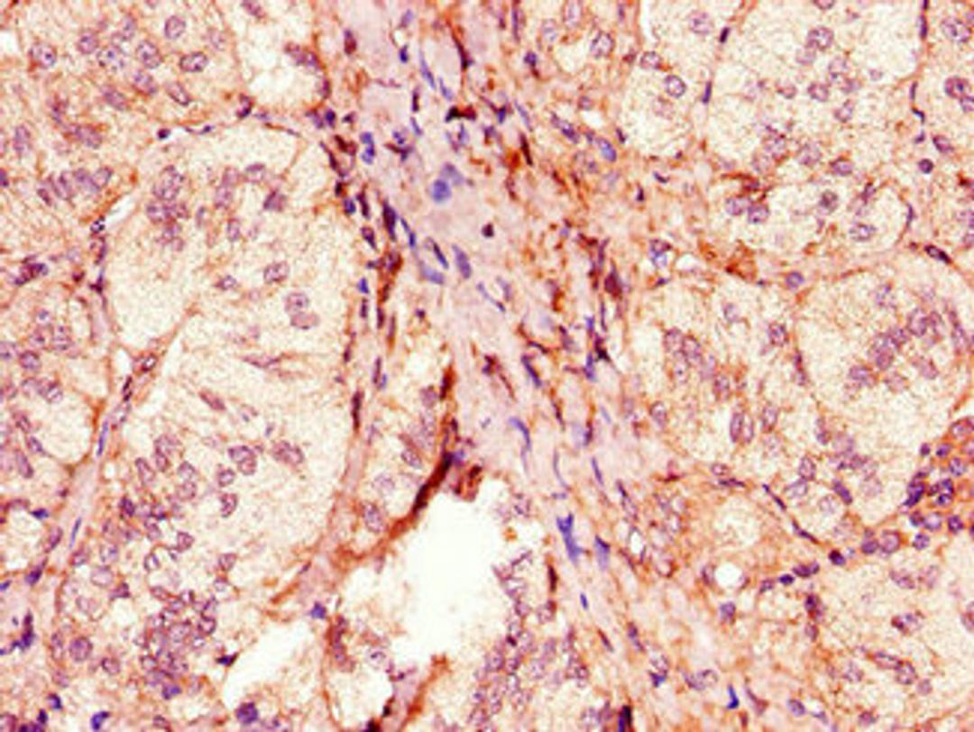 Immunohistochemistry of paraffin-embedded human adrenal gland tissue using CSB-PA617998HA01HU at dilution of 1:100