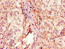 Immunohistochemistry of paraffin-embedded human adrenal gland tissue using CSB-PA617998HA01HU at dilution of 1:100