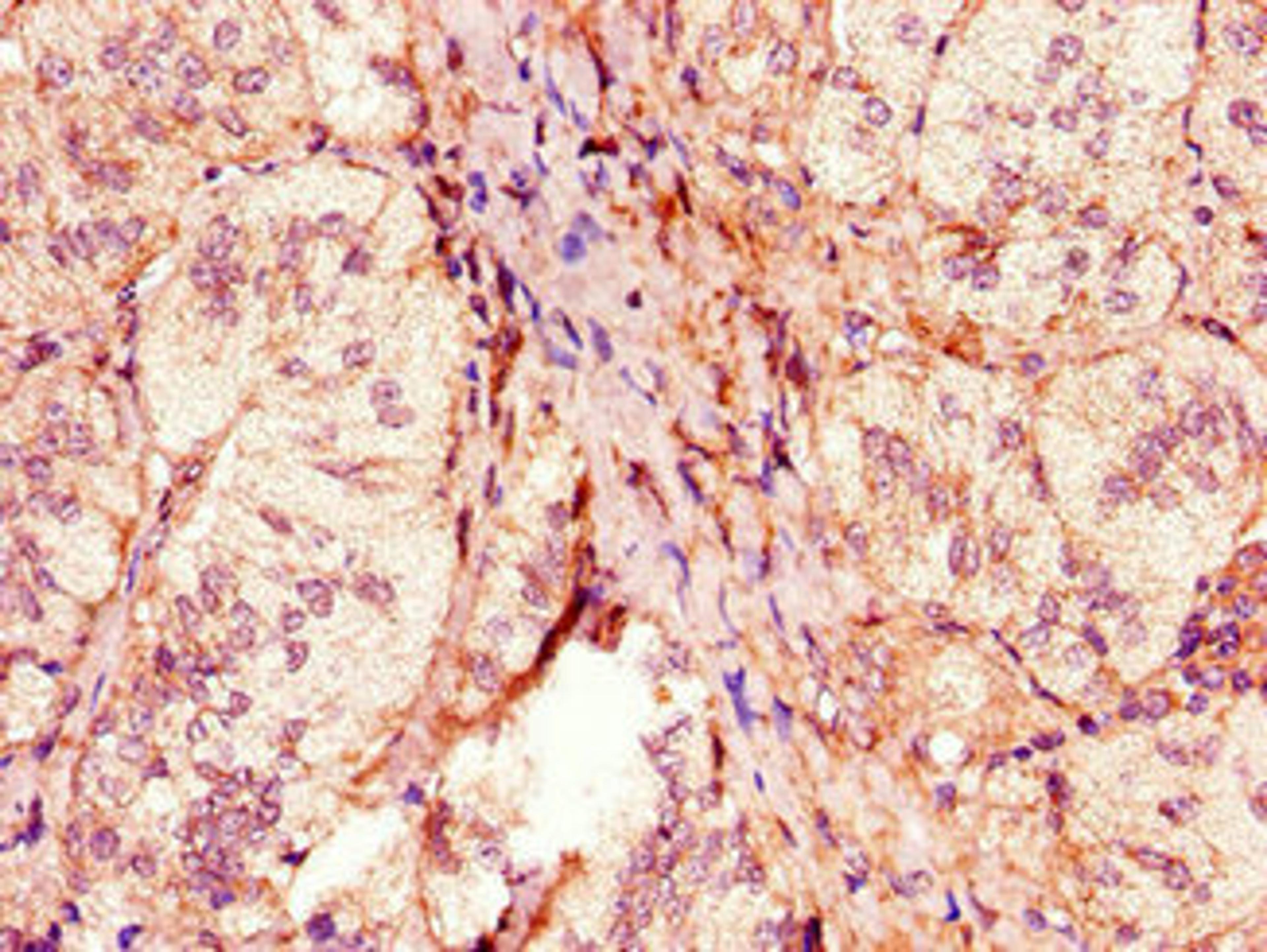 Immunohistochemistry of paraffin-embedded human adrenal gland tissue using CSB-PA617998HA01HU at dilution of 1:100