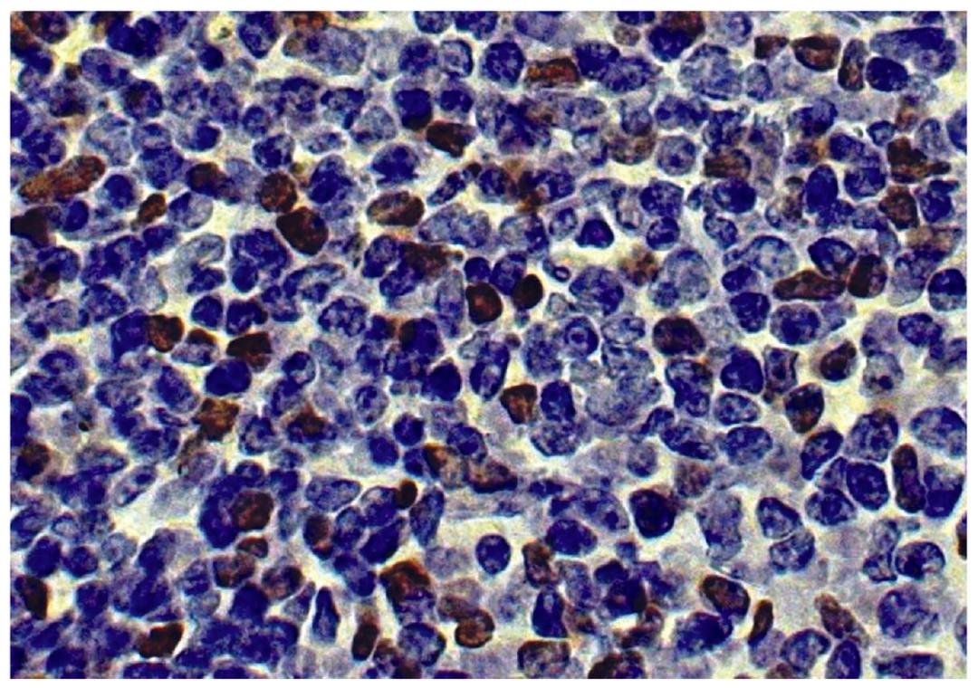 Mouse spleen tissue was stained with Rat Anti-Mouse Foxp3-UNLB (Cat. No. 99-790) followed by HRP conjugated Anti-Rat Ig secondary antibody.