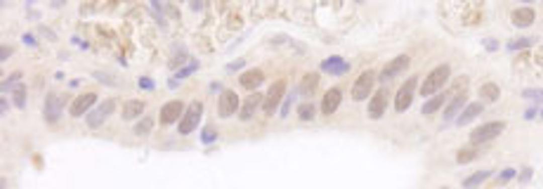 Detection of human Rad6 by immunohistochemistry.