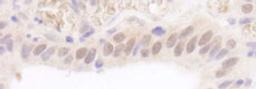 Detection of human Rad6 by immunohistochemistry.