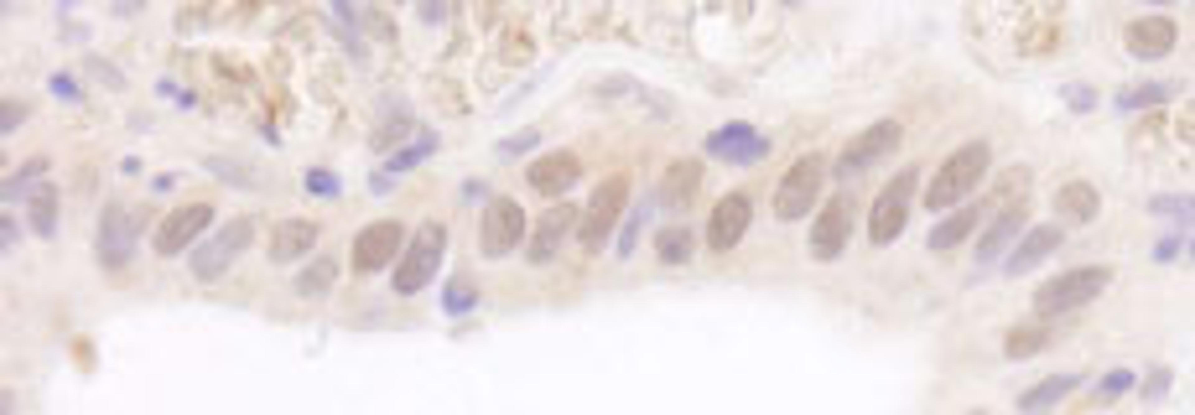 Detection of human Rad6 by immunohistochemistry.