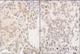 Detection of human and mouse PUF60 by immunohistochemistry.