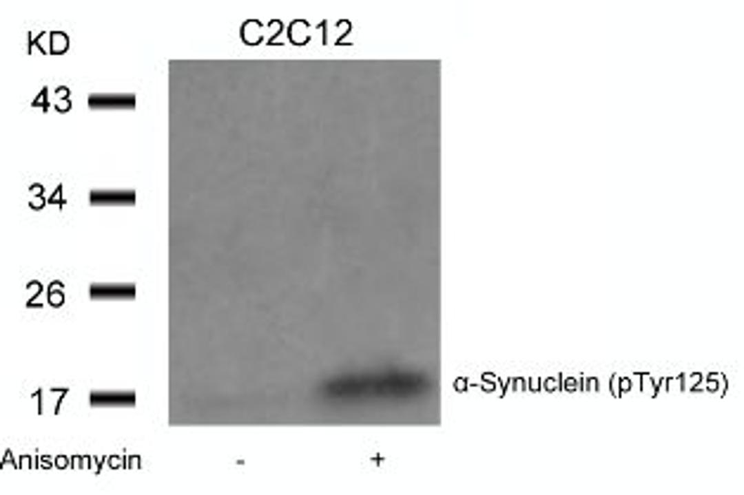 Western blot analysis of lysed extracts from C2C12 cells untreated or treated with Anisomycin using α-Synuclein (Phospho-Tyr125).