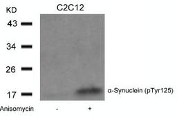 Western blot analysis of lysed extracts from C2C12 cells untreated or treated with Anisomycin using α-Synuclein (Phospho-Tyr125).