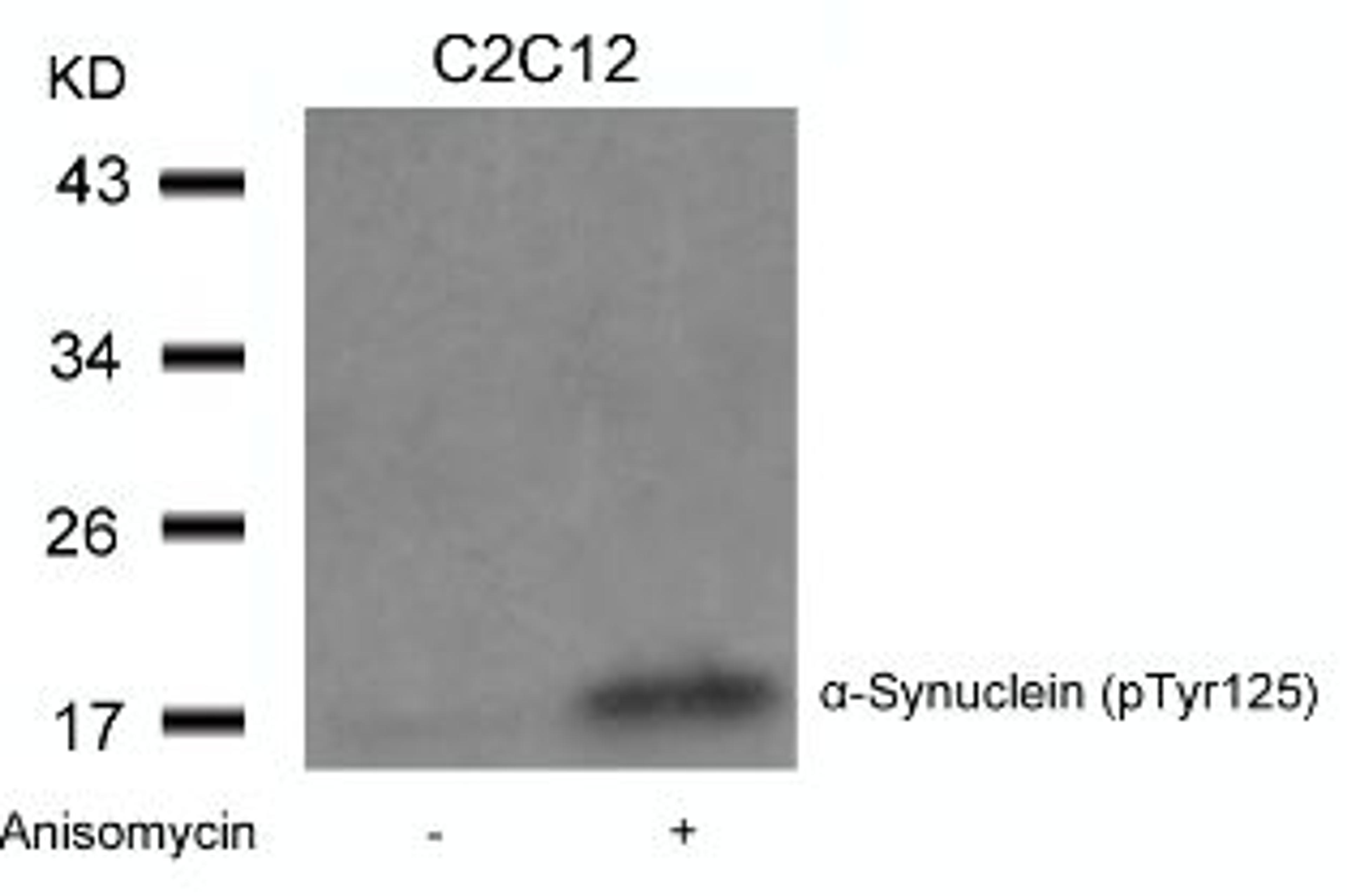 Western blot analysis of lysed extracts from C2C12 cells untreated or treated with Anisomycin using α-Synuclein (Phospho-Tyr125).