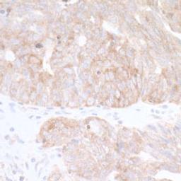 Detection of human CAD by immunohistochemistry.