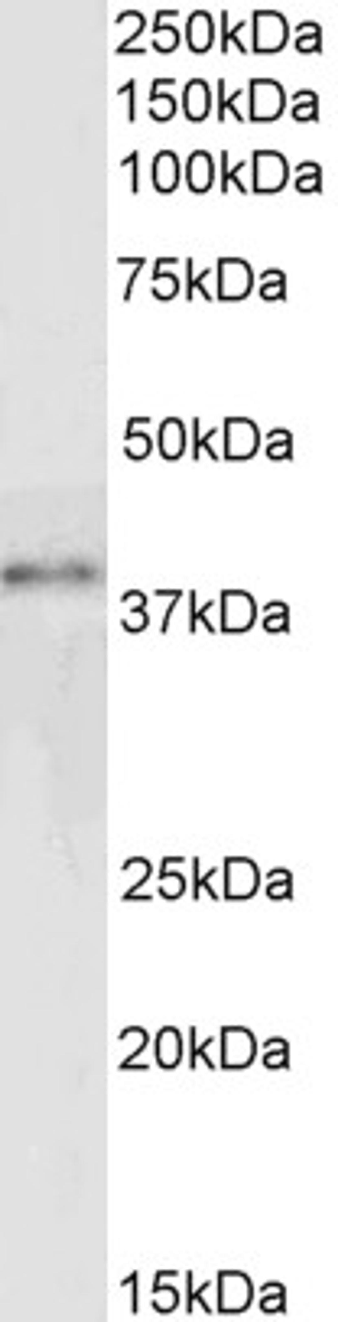 45-705 (0.3ug/ml) staining of Jurkat lysate (30ug protein in RIPA buffer). Primary incubation was 1 hour. Detected by chemiluminescence.