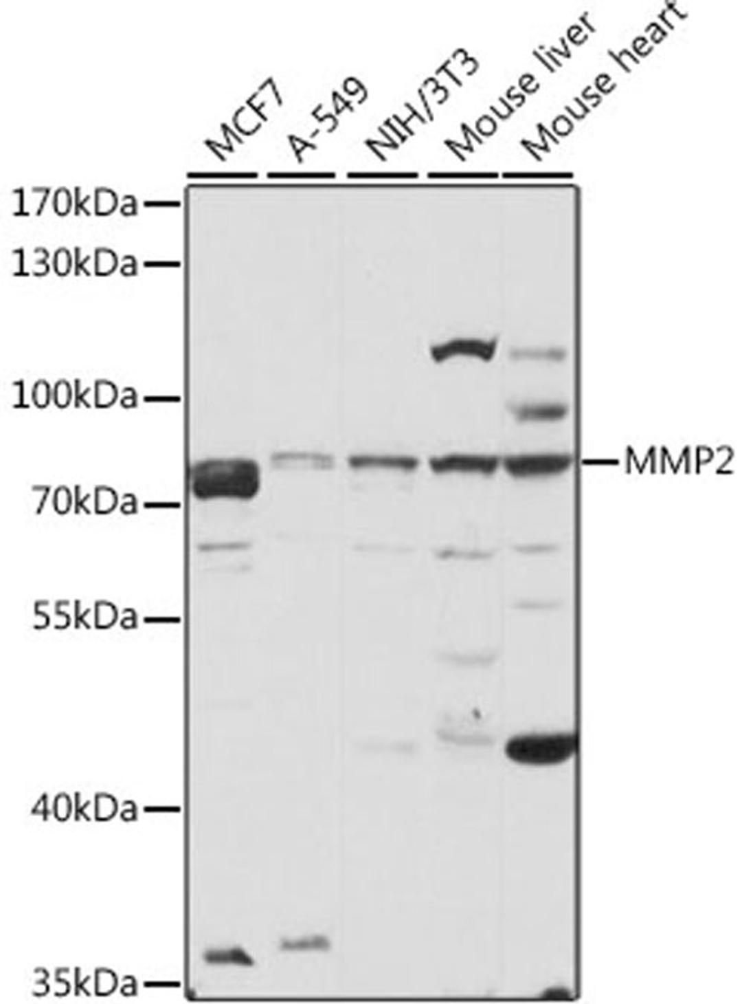 Western blot - MMP2 antibody (A11144)