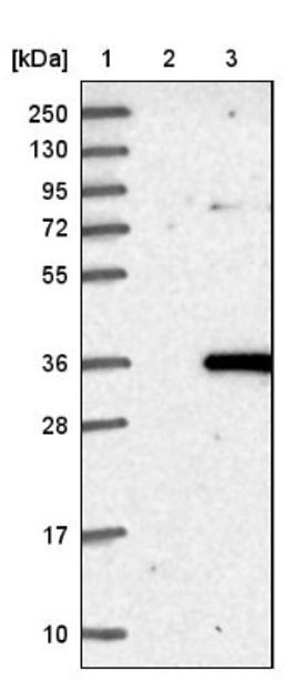 Western Blot: ROGDI Antibody [NBP1-82123] - Lane 1: Marker [kDa] 250, 130, 95, 72, 55, 36, 28, 17, 10<br/>Lane 2: Negative control (vector only transfected HEK293T lysate)<br/>Lane 3: Over-expression lysate (Co-expressed with a C-terminal myc-DDK tag (~3.1 kDa) in mammalian HEK293T cells, LY411224)