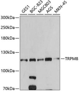 Western blot - TRPM8 antibody (A5333)