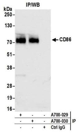 Detection of human CD86 by western blot of immunoprecipitates.