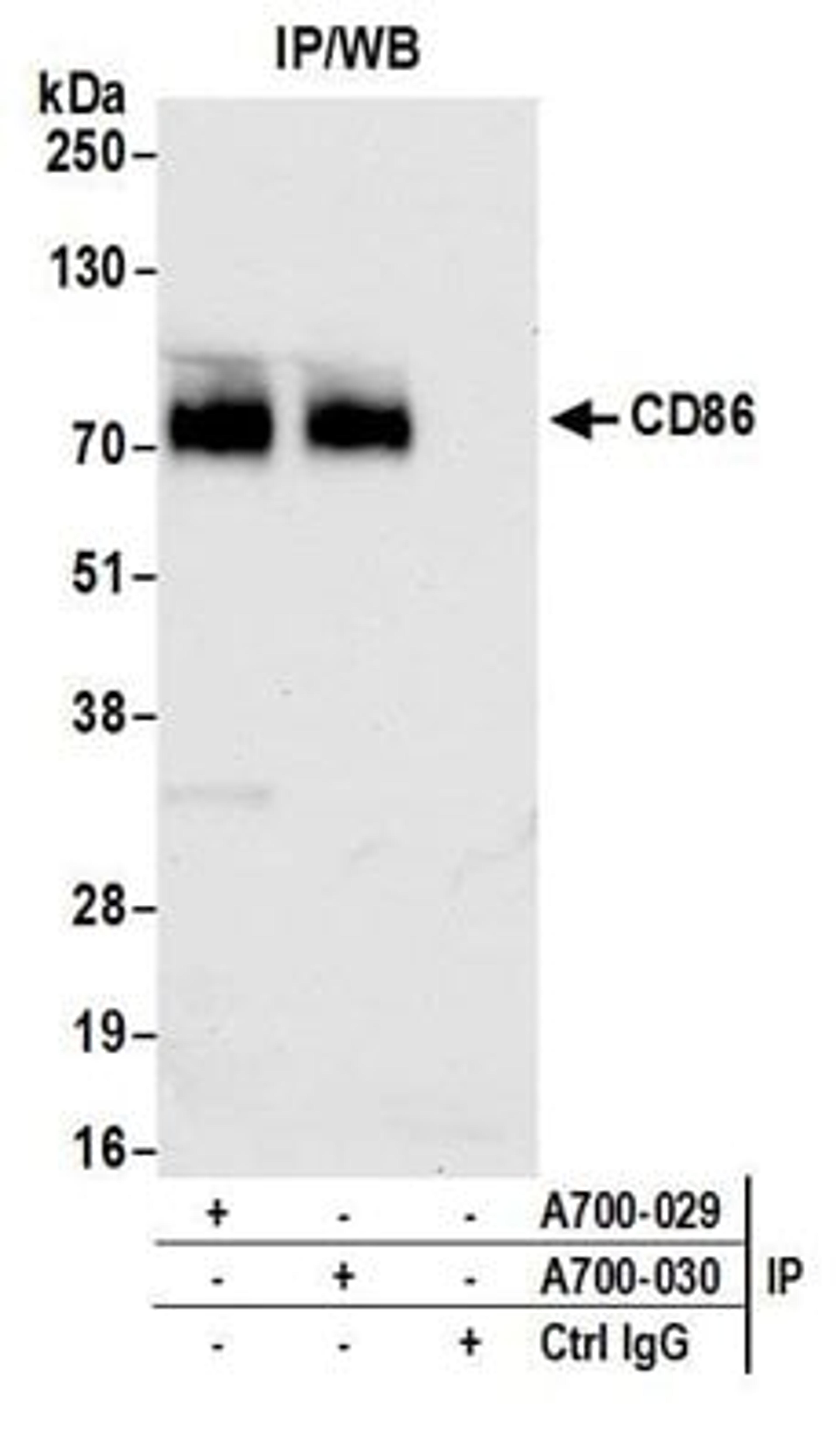 Detection of human CD86 by western blot of immunoprecipitates.