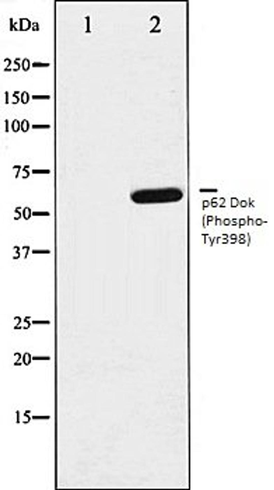 Western blot analysis of K562 whole cell lysates using p62 Dok (Phospho-Tyr398) antibody, The lane on the left is treated with the antigen-specific peptide.