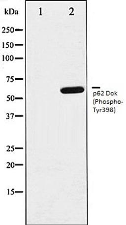 Western blot analysis of K562 whole cell lysates using p62 Dok (Phospho-Tyr398) antibody, The lane on the left is treated with the antigen-specific peptide.