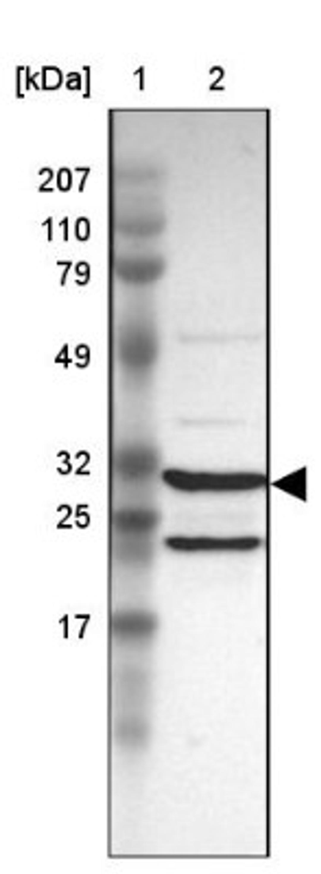 Western Blot: Proteasome 20S alpha 3 Antibody [NBP1-92293] - Lane 1: Marker [kDa] 207, 110, 79, 49, 32, 25, 17<br/>Lane 2: Human cell line RT-4