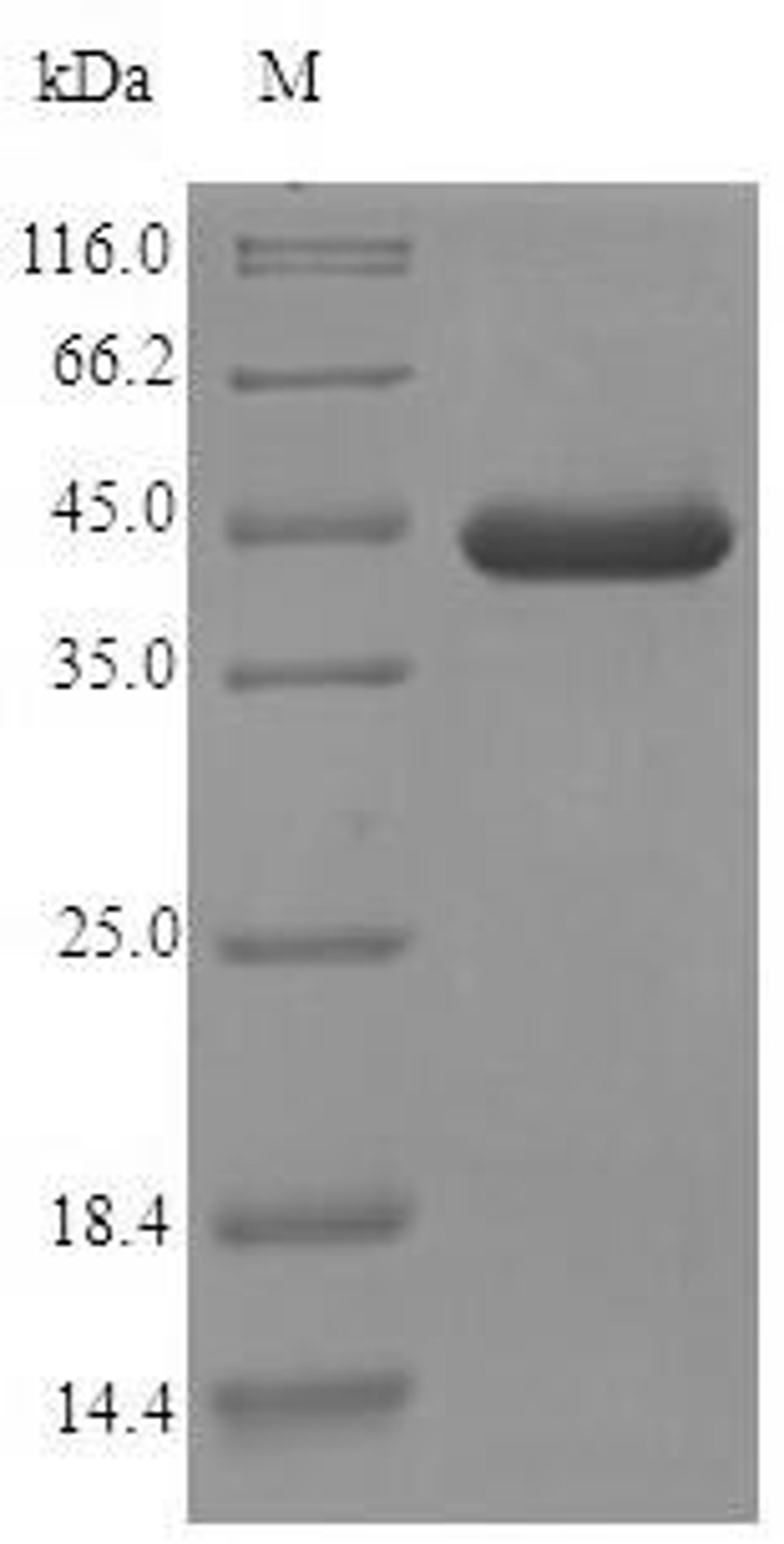 (Tris-Glycine gel) Discontinuous SDS-PAGE (reduced) with 5% enrichment gel and 15% separation gel.
