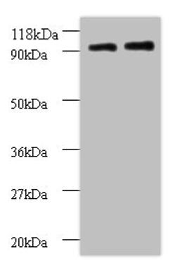 Western blot. All lanes: RPS12 antibody at 2µg/ml. Lane 1: EC109 whole cell lysate. Lane 2: 293T whole cell lysate. Secondary. Goat polyclonal to rabbit IgG at 1/15000 dilution. Predicted band size: 15 kDa. Observed band size: 90 kDa
