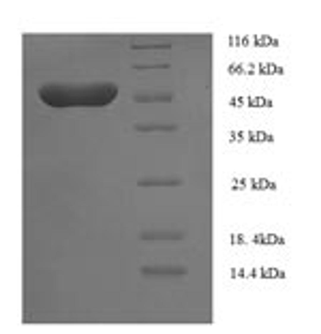 (Tris-Glycine gel) Discontinuous SDS-PAGE (reduced) with 5% enrichment gel and 15% separation gel.