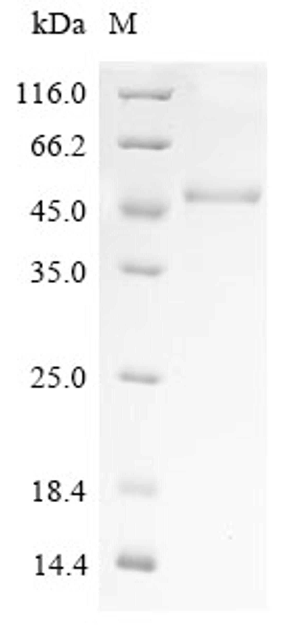 (Tris-Glycine gel) Discontinuous SDS-PAGE (reduced) with 5% enrichment gel and 15% separation gel.