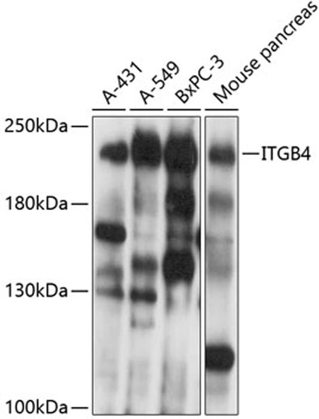 Western blot - ITGB4 antibody (A0857)