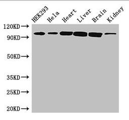 Western Blot. Positive WB detected in: HEK293 whole cell lysate, Hela whole cell lysate, Mouse heart tissue, Mouse liver tissue, Mouse brain tissue, Mouse kidney tissue. All lanes: CDH2 antibody at 3ug/ml. Secondary. Goat polyclonal to rabbit IgG at 1/50000 dilution. Predicted band size: 100, 98 kDa. Observed band size: 100 kDa.