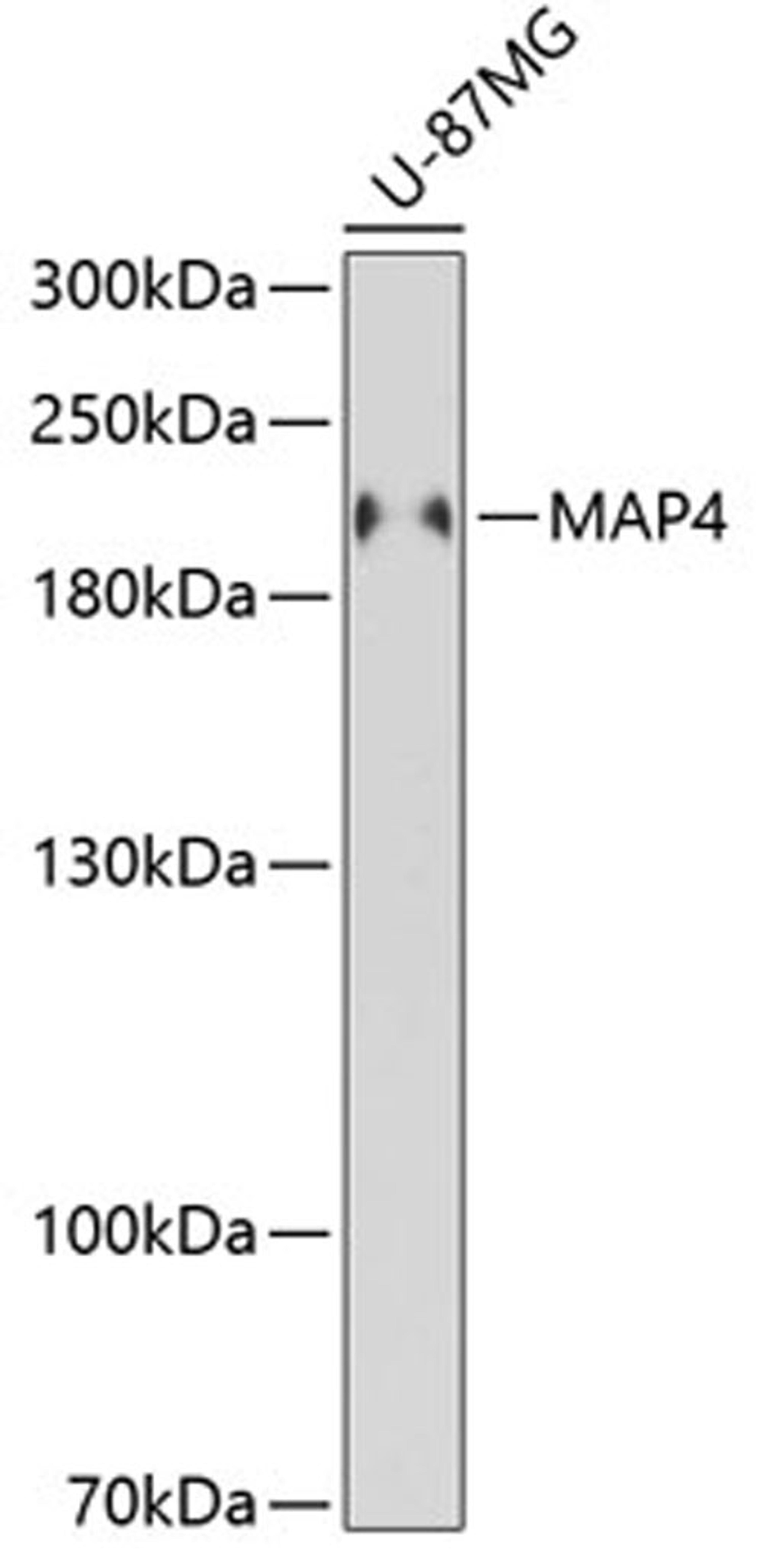 Western blot - MAP4 antibody (A5906)