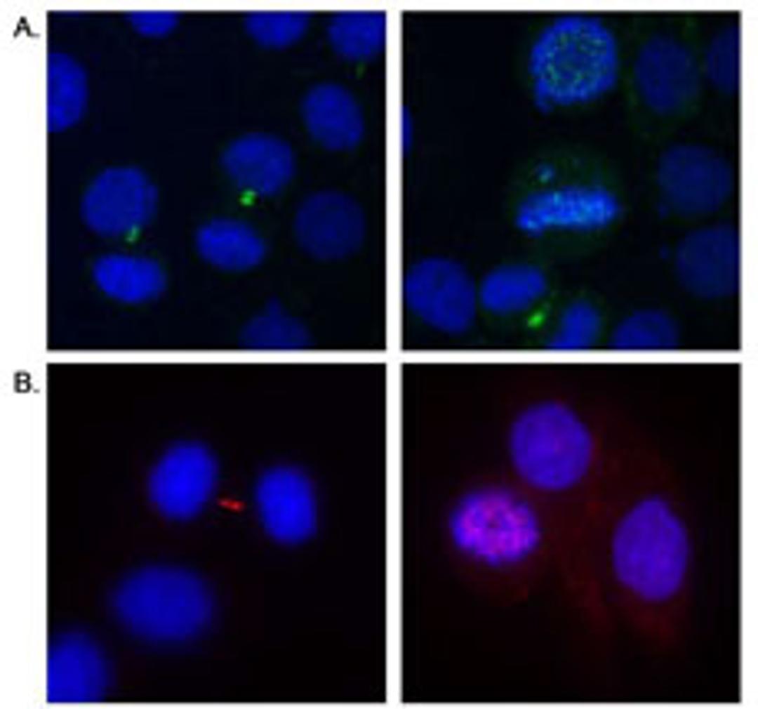 Detection of human Aurora B by immunocytochemistry.