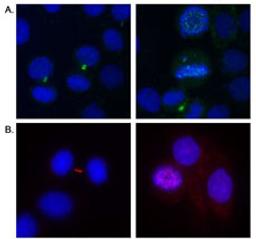 Detection of human Aurora B by immunocytochemistry.