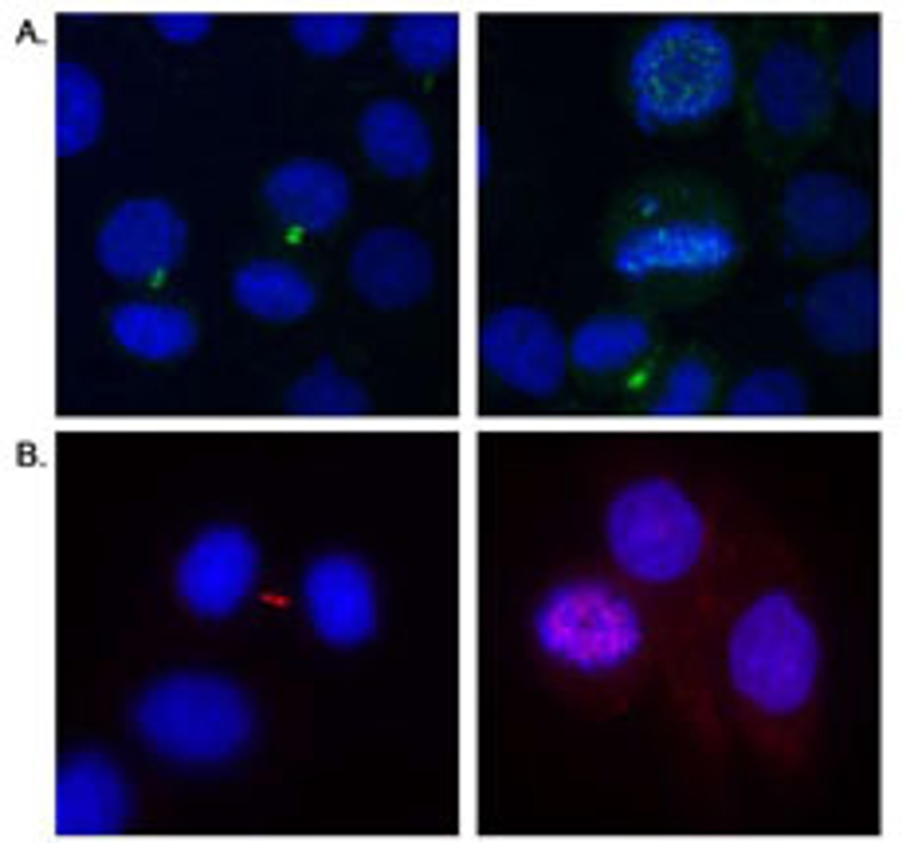 Detection of human Aurora B by immunocytochemistry.