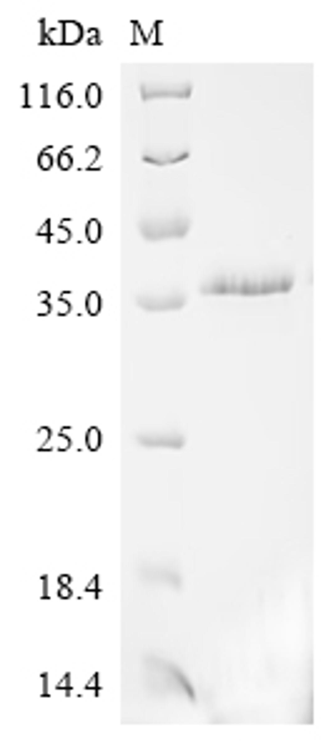 (Tris-Glycine gel) Discontinuous SDS-PAGE (reduced) with 5% enrichment gel and 15% separation gel.