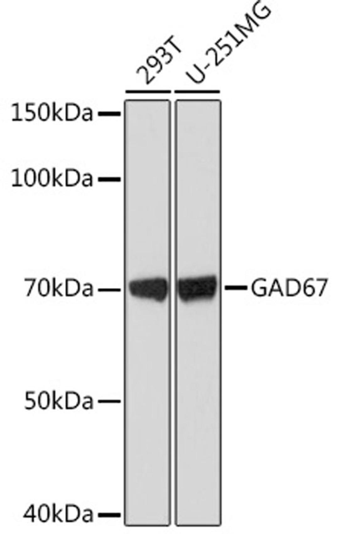 Western blot - GAD67 Rabbit mAb (A1475)