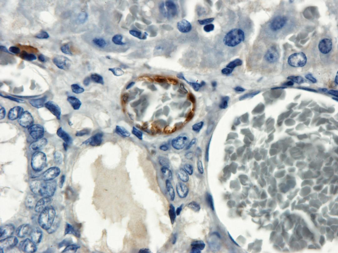 Immunohistochemical staining of rat liver vessel tissue using anti-VEGFR2 (dilution of primary antibody - 1:200)