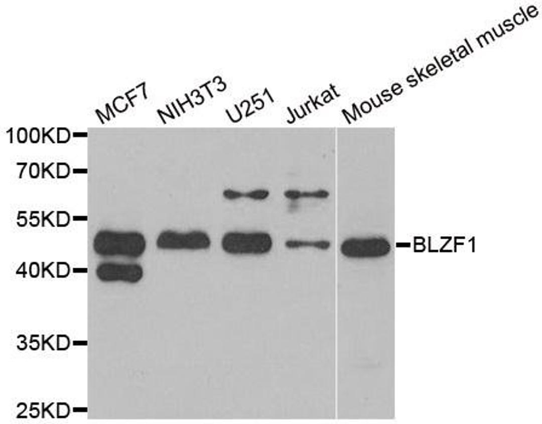 Western blot analysis of extracts of various cell lines using BLZF1 antibody