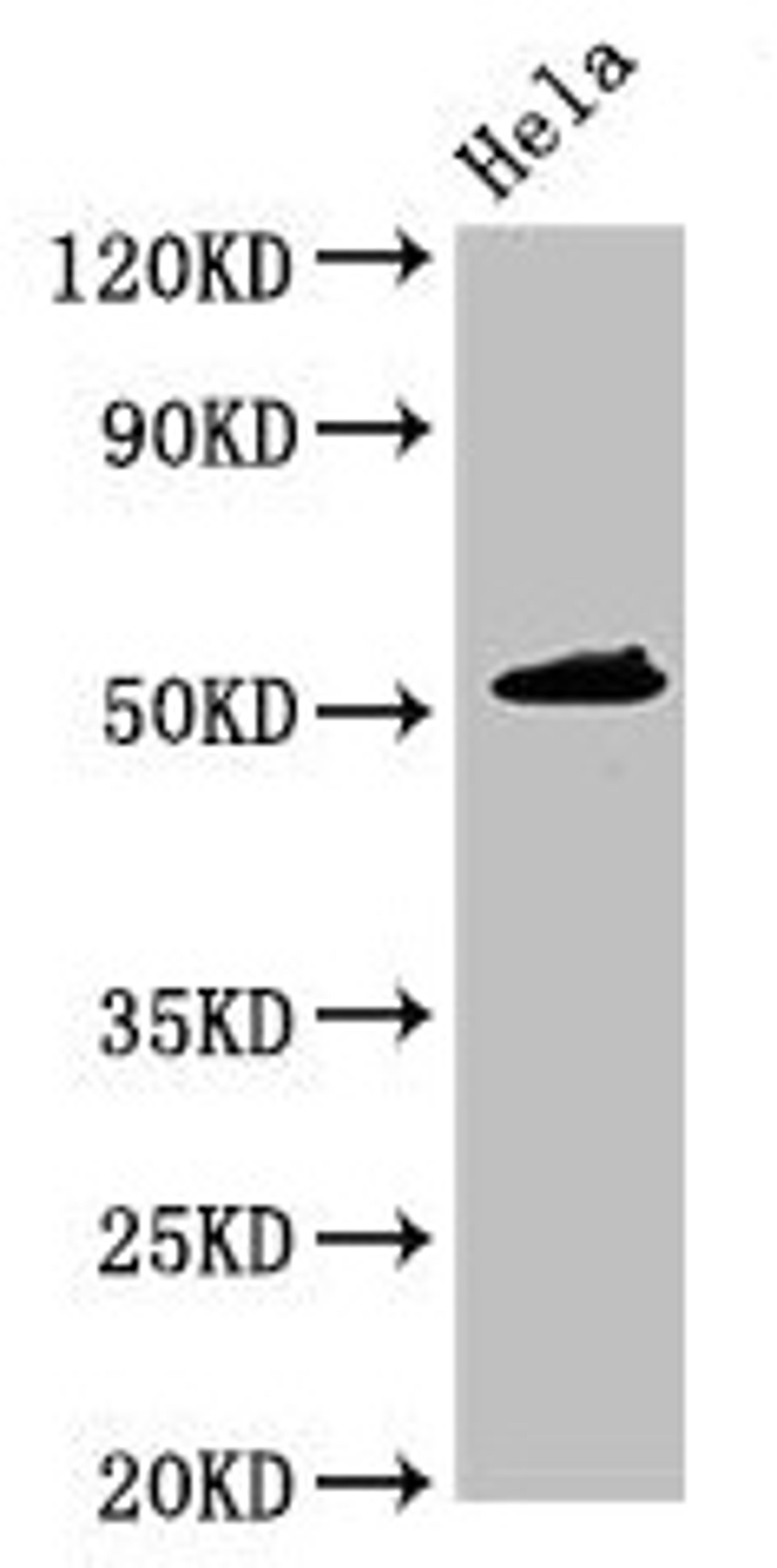 Western Blot. Positive WB detected in: Hela whole cell lysate. All lanes: IP6K1 antibody at 3.5ug/ml. Secondary. Goat polyclonal to rabbit IgG at 1/50000 dilution. Predicted band size: 51, 32 kDa. Observed band size: 51 kDa