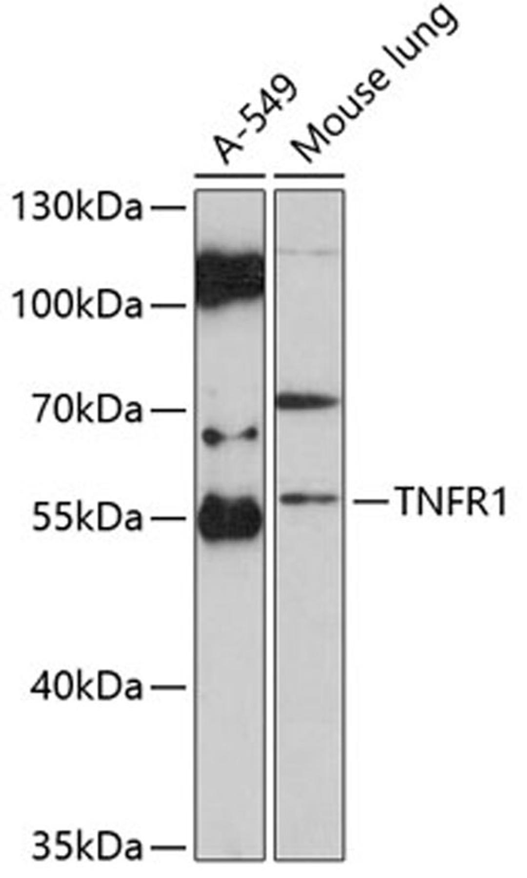 Western blot - TNFR1 antibody (A1540)