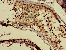 Immunohistochemistry of paraffin-embedded human testis tissue using CSB-PA009594LA01HU at dilution of 1:100