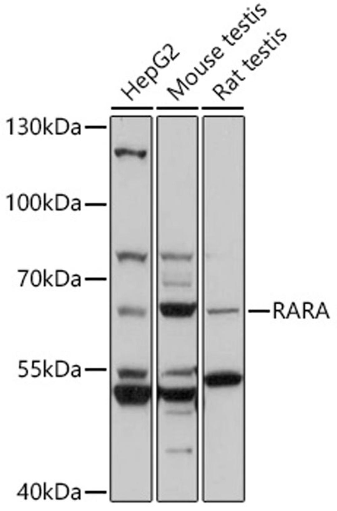 Western blot - RARA antibody (A0370)