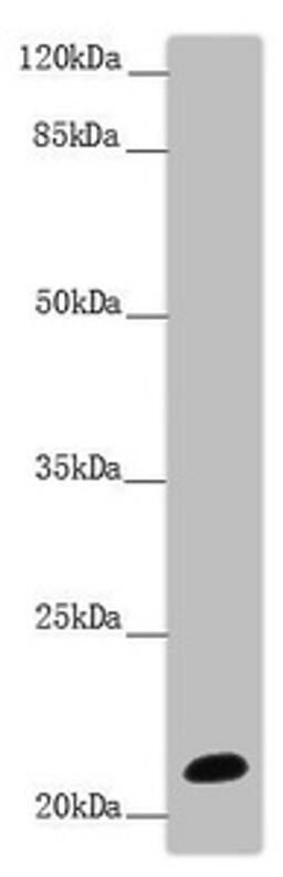 Western blot. All lanes: NCALD antibody at 9.32 ug/ml + Mouse brain tissue. Secondary. Goat polyclonal to rabbit IgG at 1/10000 dilution. Predicted band size: 22 kDa. Observed band size: 22 kDa. 