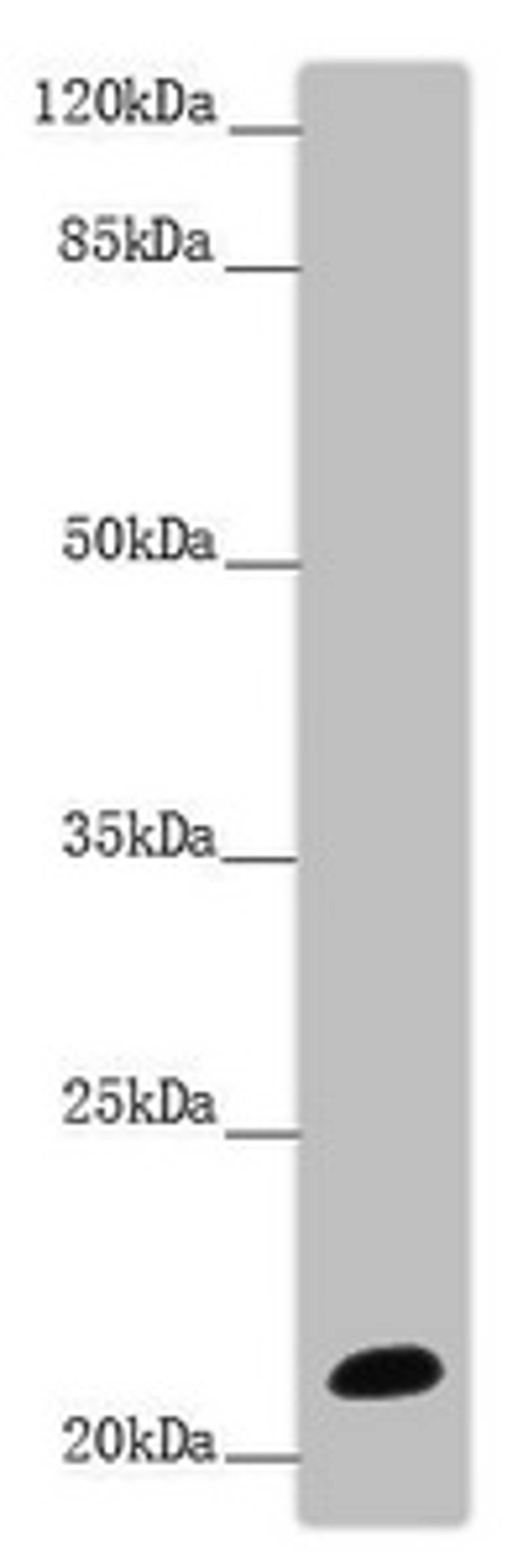 Western blot. All lanes: NCALD antibody at 9.32 ug/ml + Mouse brain tissue. Secondary. Goat polyclonal to rabbit IgG at 1/10000 dilution. Predicted band size: 22 kDa. Observed band size: 22 kDa. 