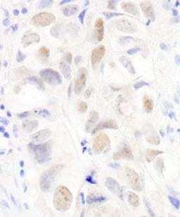 Detection of human Anillin by immunohistochemistry.