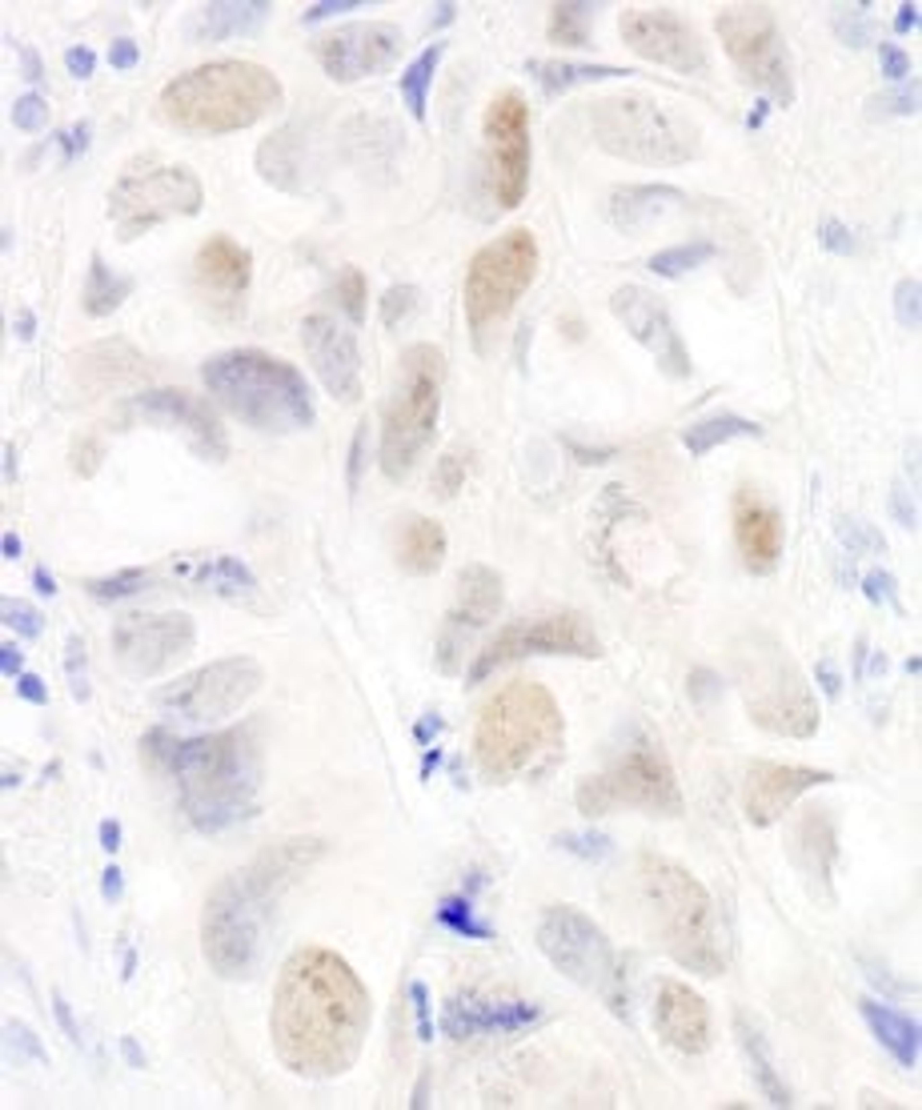 Detection of human Anillin by immunohistochemistry.