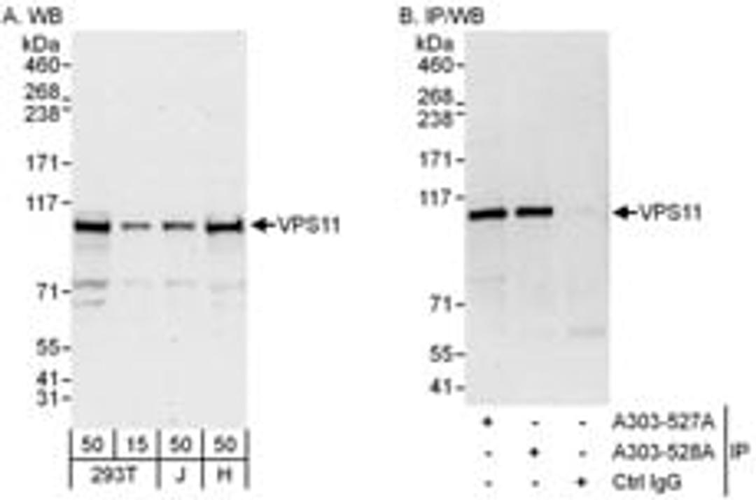 Detection of human VPS11 by western blot and immunoprecipitation.