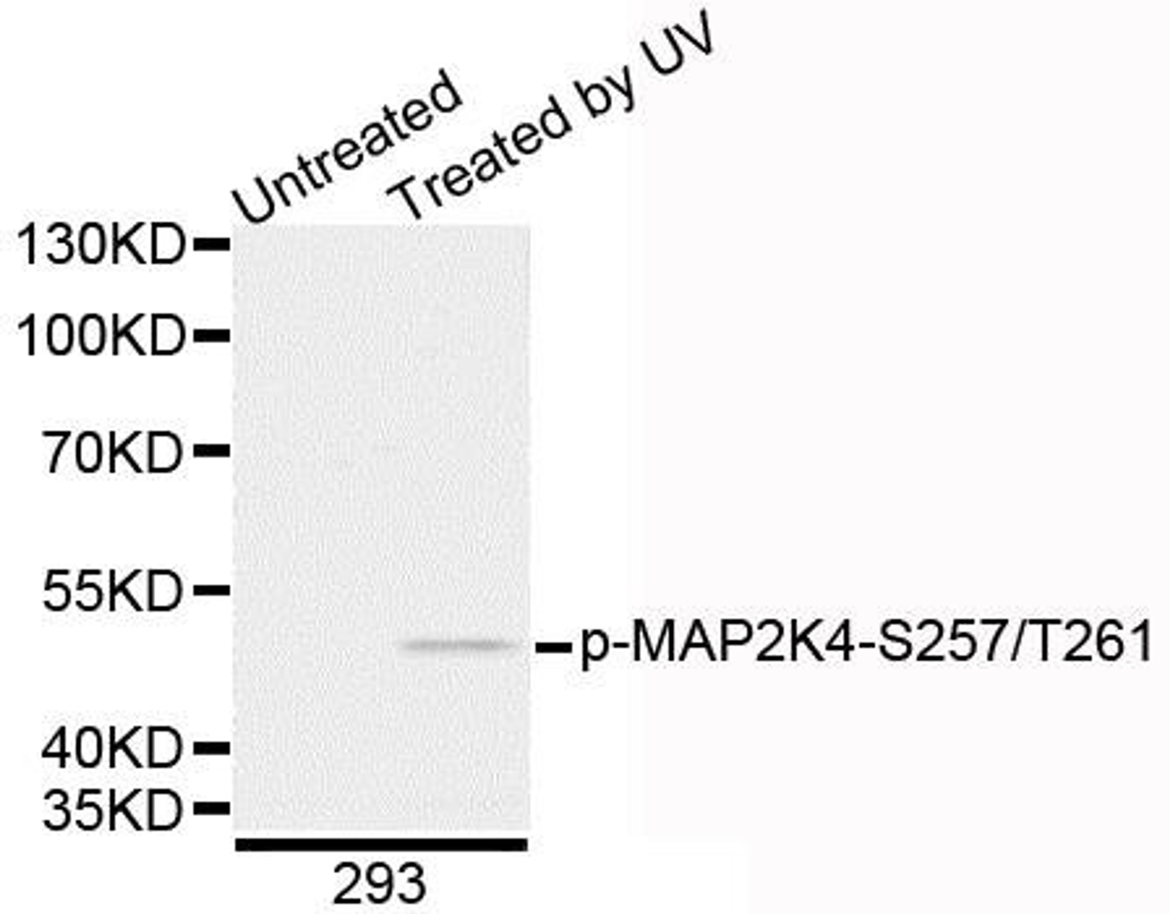 Western blot analysis of extracts of 293 cells using MAP2K4 (Phospho-S257/T261) antibody