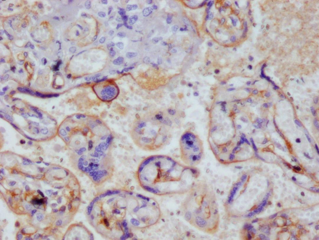 IHC image of CSB-RA222792A0HU diluted at 1:100 and staining in paraffin-embedded human placenta tissue performed on a Leica BondTM system. After dewaxing and hydration, antigen retrieval was mediated by high pressure in a citrate buffer (pH 6.0). Section was blocked with 10% normal goat serum 30min at RT. Then primary antibody (1% BSA) was incubated at 4°C overnight. The primary is detected by a Goat anti-rabbit polymer IgG labeled by HRP and visualized using 0.05% DAB.